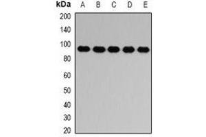 Western blot analysis of PTP epsilon expression in HL60 (A), SW620 (B), mouse brain (C), mouse spleen (D), rat lung (E) whole cell lysates.