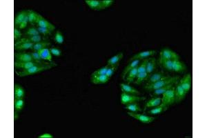 Immunofluorescent analysis of HepG2 cells using ABIN7154159 at dilution of 1:100 and Alexa Fluor 488-congugated AffiniPure Goat Anti-Rabbit IgG(H+L) (GPD1 Antikörper  (AA 1-349))