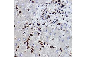 Immunohistochemistry of paraffin-embedded human liver using L-Plastin/LCP1 Rabbit mAb (ABIN7268317) at dilution of 1:100 (40x lens). (LCP1 Antikörper)