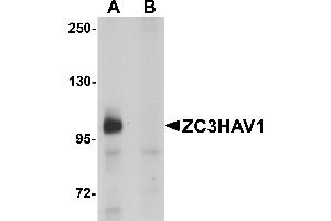Western Blotting (WB) image for anti-Zinc Finger CCCH-Type, Antiviral 1 (ZC3HAV1) (C-Term) antibody (ABIN1030817)