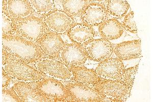 ABIN6263424 and ABIN6269252 at 1/100 staining Rat testis tissue by IHC-P. (MTOR Antikörper  (C-Term))