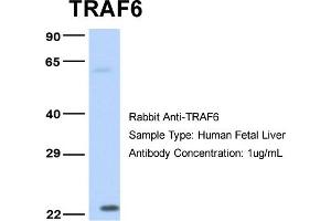 Host: Rabbit Target Name: TRAF6 Sample Type: Human Fetal Liver Antibody Dilution: 1. (TRAF6 Antikörper  (Middle Region))