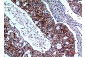 Immunohistochemistry (IHC) image for anti-Interleukin 1 Receptor, Type II (IL1R2) (Internal Region) antibody (ABIN6281356)