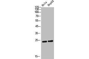 Western Blot analysis of Hela HepG2 cells using AID Polyclonal Antibody (AICDA Antikörper  (Internal Region))