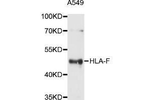 Western blot analysis of extracts of A-549 cells, using HLA-F antibody (ABIN5997910) at 1/1000 dilution. (HLA-F Antikörper)