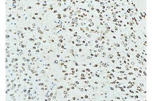 IHC analysis of RPL23 using anti-RPL23 antibody (ABIN7599808). (RPL23 Antikörper  (AA 12-136))