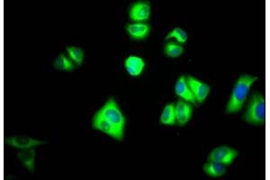 Immunofluorescence staining of Hela Cells with ABIN7127769 at 1:50, counter-stained with DAPI. (Rekombinanter PKM Antikörper)