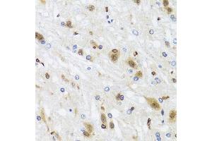 Immunohistochemistry of paraffin-embedded rat brain using HDAC4 antibody (ABIN4903045) at dilution of 1:100 (40x lens). (TUBB Antikörper)