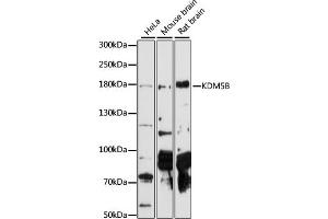 Western blot analysis of extracts of various cell lines, using KDM5B antibody  at 1:1000 dilution. (KDM5B Antikörper  (AA 784-883))