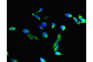 Immunofluorescent analysis of Hela cells using ABIN7156464 at dilution of 1:100 and Alexa Fluor 488-congugated AffiniPure Goat Anti-Rabbit IgG(H+L) (CD11b Antikörper  (AA 46-150))