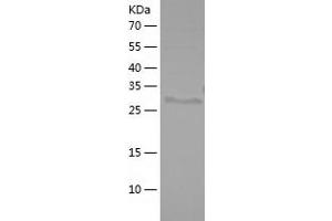 Western Blotting (WB) image for TAF1 RNA Polymerase II, TATA Box Binding Protein (TBP)-Associated Factor, 250kDa (TAF1) (AA 1400-1651) protein (His tag) (ABIN7125309) (TAF1 Protein (AA 1400-1651) (His tag))