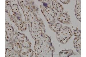 Image no. 1 for anti-SMC6 Structural Maintenance of Chromosomes 6-Like 1 (SMC6) (AA 1-110) antibody (ABIN599304) (SMC6 Antikörper  (AA 1-110))