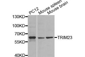 Western blot analysis of extracts of various cell lines, using TRIM23 antibody (ABIN5974665) at 1/1000 dilution. (TRIM23 Antikörper)
