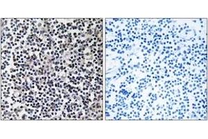Immunohistochemistry (IHC) image for anti-Transforming, Acidic Coiled-Coil Containing Protein 3 (TACC3) (AA 789-838) antibody (ABIN2890716)