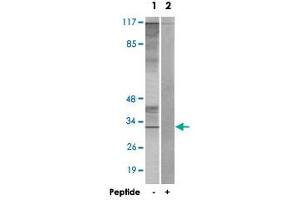 Western blot analysis of extracts from K-562 cells, using CIB3 polyclonal antibody . (CIB3 Antikörper  (C-Term))