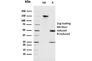 SDS-PAGE Analysis Purified MAGEA4 Mouse Monoclonal Antibody (CPTC-MAGEA4-1). (MAGEA4 Antikörper)