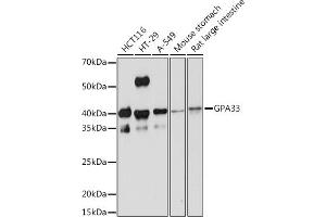 Western blot analysis of extracts of various cell lines, using GP Rabbit mAb (ABIN1682863, ABIN3017875, ABIN3017876 and ABIN7101532) at 1:1000 dilution. (GPA33 Antikörper)