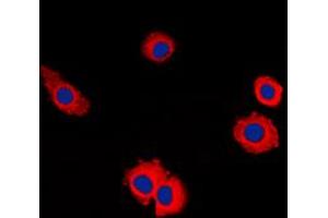 Immunofluorescent analysis of MUC16 staining in HuvEc cells. (MUC16 Antikörper  (Center))