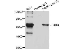Immunoprecipitation analysis of 200 μg extracts of SW620 cells using 3 μg P4HB antibody (ABIN5970266). (P4HB Antikörper)