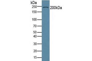 Detection of COL6a3 in Human Serum using Polyclonal Antibody to Collagen Type VI Alpha 3 (COL6a3) (COL6a3 Antikörper  (AA 463-624))