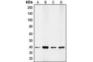 Western Blotting (WB) image for anti-Caudal Type Homeobox 2 (CDX2) (Center) antibody (ABIN7295244)