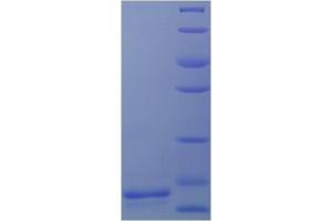 Immunohistochemistry (IHC) image for Transforming Growth Factor, beta 1 (TGFB1) (AA 30-278) protein (His tag) (ABIN7586319)