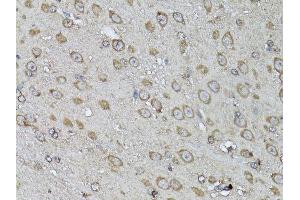 Immunohistochemistry of paraffin-embedded mouse brain using SNAI1 antibody. (SNAIL Antikörper  (AA 1-264))