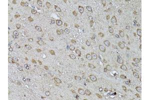 Immunohistochemistry of paraffin-embedded mouse brain using SNAI1 antibody. (SNAIL Antikörper  (AA 1-264))