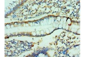 Immunohistochemistry of paraffin-embedded human small intestine tissue using ABIN7147898 at dilution of 1:100 (Claudin 2 Antikörper  (AA 30-230))