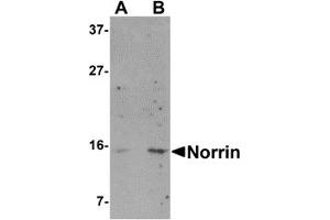 Western Blotting (WB) image for anti-Norrie Disease (Pseudoglioma) (NDP) (N-Term) antibody (ABIN1031487) (Norrie Disease (Pseudoglioma) Antikörper  (N-Term))