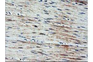 Immunohistochemical staining of paraffin-embedded Human colon tissue using anti-ARL11 mouse monoclonal antibody. (ARL11 Antikörper)