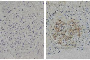 Immunohistochemistry (IHC) image for Mouse anti-Human IgG3 (Hinge Region) antibody (ABIN135664)