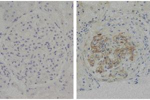 Paraffin embedded glomerular basement membrane tissue sections from patients with Anti-GBM disease were stained with Mouse Anti-Human IgG3 Hinge-UNLB (Maus anti-Human IgG3 (Hinge Region) Antikörper)