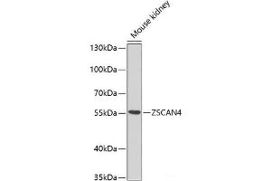 Western blot analysis of extracts of Mouse kidney using ZSCAN4C Polyclonal Antibody at dilution of 1:1000. (ZSCAN4C Antikörper)