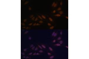 Immunofluorescence analysis of U-2 OS cells using EED Polyclonal Antibody (ABIN6133691, ABIN6139940, ABIN6139943 and ABIN6216521) at dilution of 1:100 (40x lens). (EED Antikörper  (AA 1-100))