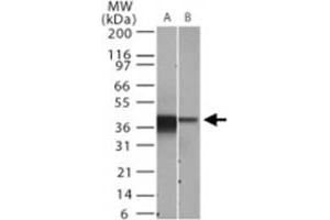 Western blot analysis of NFKBIA. (NFKBIA Antikörper  (AA 32-291))
