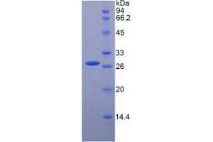 SDS-PAGE analysis of Mouse HGF Protein. (HGF Protein)