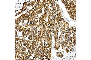 Immunohistochemistry (IHC) image for anti-VAMP (Vesicle-Associated Membrane Protein)-Associated Protein B and C (VAPB) (AA 10-222) antibody (ABIN6150058)