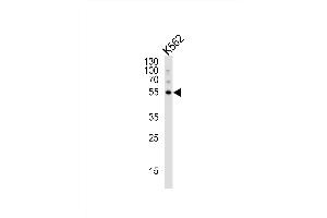 Western blot analysis of lysate from K562 cell line, using G5 Antibody 1812c. (ATG5 Antikörper)
