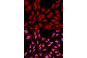 Immunofluorescence analysis of U2OS cells using BAG1 antibody (ABIN5970457). (BAG1 Antikörper)