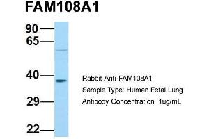 Host: Rabbit  Target Name: FAM108A1  Sample Tissue: Human Fetal Lung  Antibody Dilution: 1. (ABHD17A Antikörper  (C-Term))