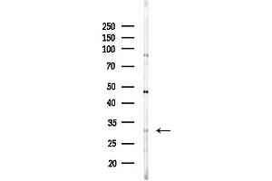 anti-ChaC, Cation Transport Regulator Homolog 1 (CHAC1) (Internal Region) antibody
