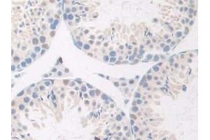 Detection of GnRH in Mouse Testis Tissue using Polyclonal Antibody to Gonadotropin Releasing Hormone (GnRH) (GNRH1 Antikörper  (AA 22-90))