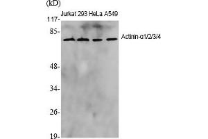Western Blot analysis of various cells using Actinin-α1/2/3/4 Polyclonal Antibody diluted at 1:1000. (ACTN1/2/3/4 Antikörper  (AA 40-120))