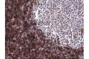 Immunohistochemistry (IHC) image for anti-T-cell surface glycoprotein CD1c (CD1C) antibody (ABIN2670659) (CD1c Antikörper)