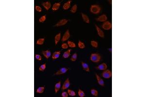 Immunofluorescence analysis of L929 cells using HPS4 antibody (ABIN7267623) at dilution of 1:100. (HPS4 Antikörper  (AA 550-650))