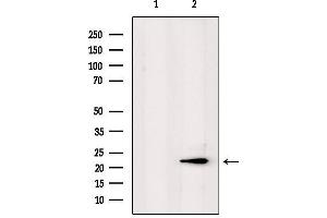 Western blot analysis of extracts from mouse lung, using PPP1R2P3 Antibody. (PPP1R2P3 Antikörper)
