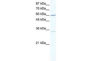 Human Jurkat; WB Suggested Anti-ZNF668 Antibody Titration: 0. (ZNF668 Antikörper  (N-Term))