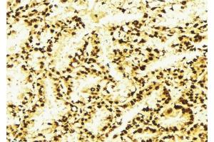 ABIN6276976 at 1/100 staining Human lung tissue by IHC-P. (PSMD10 Antikörper  (C-Term))
