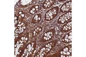 Immunohistochemical staining of human colon with CCDC125 polyclonal antibody  shows strong cytoplasmic positivity in glandular cells.